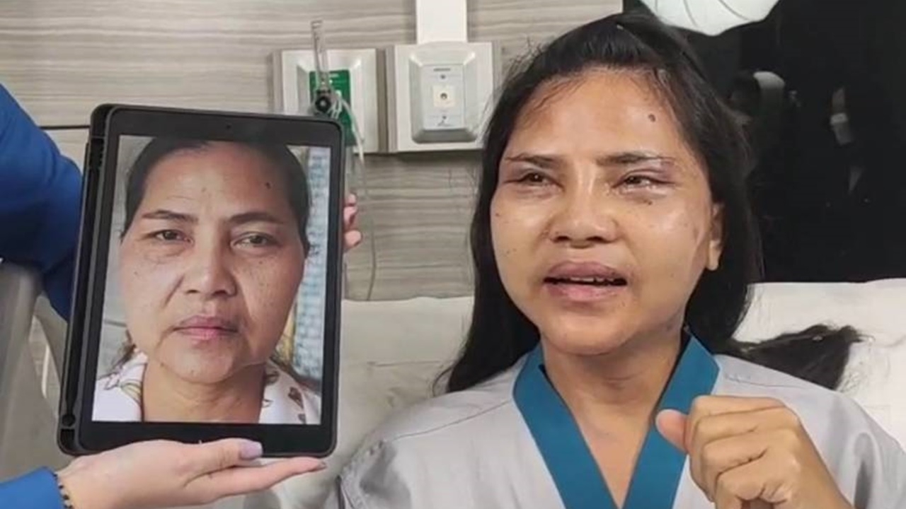 เผยภาพ สุนารี ราชสีมา หลังทำศัลยกรรมดึงหน้า แก้ไขหนังตาตก (คลิป)