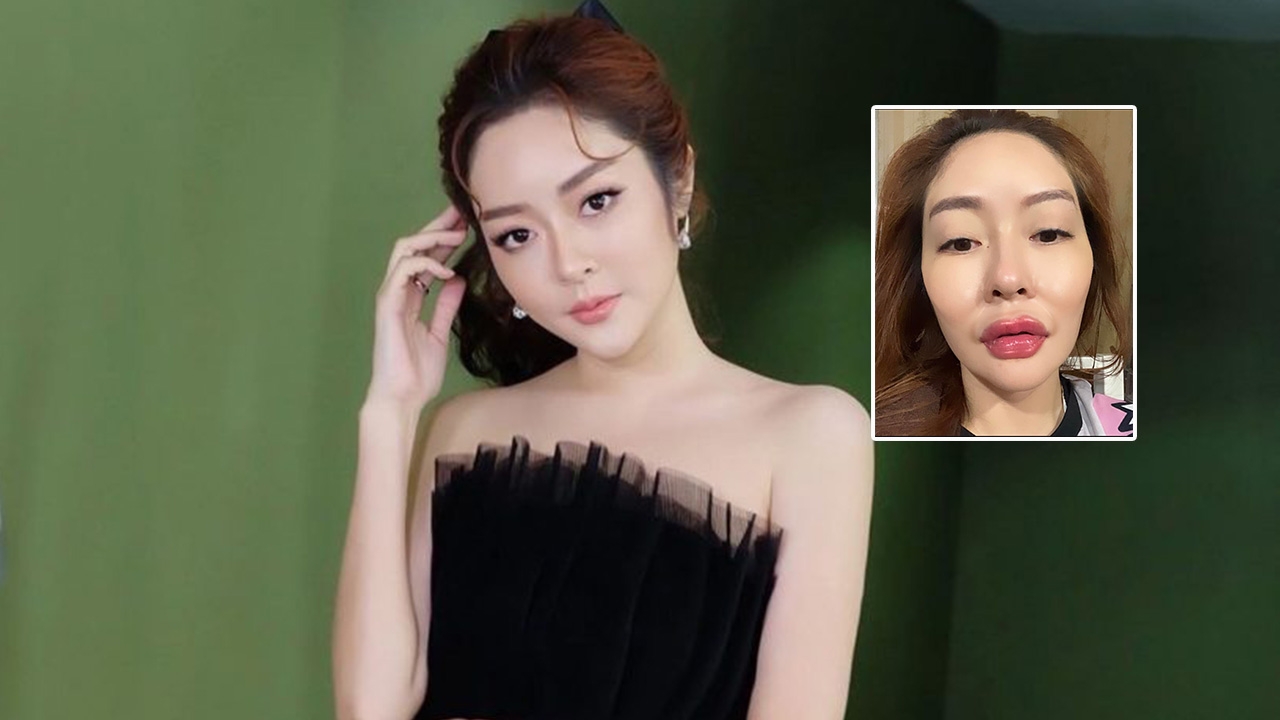 แก้มบุ๋ม ปรียาดา เผยภาพล่าสุดของตัวเอง บอกฉีดทั้งทีต้องให้โลกรู้ไปเลย