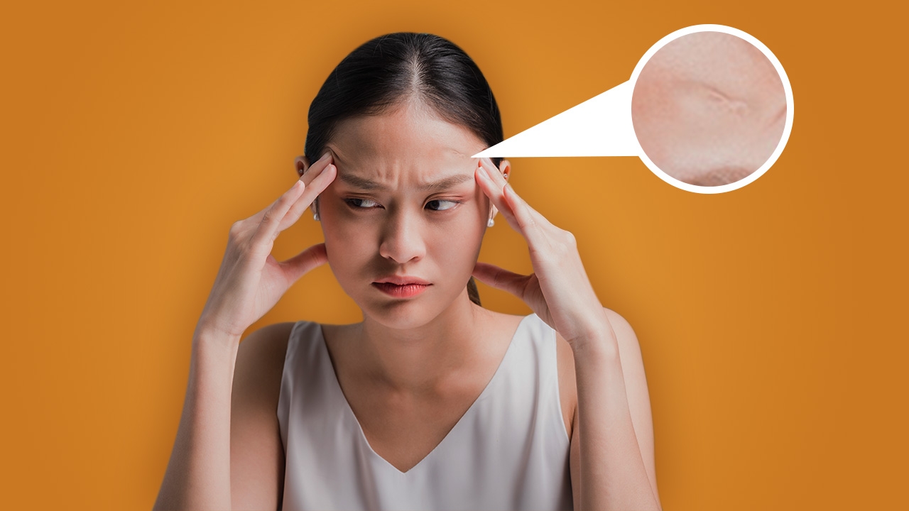 หน้าผากเป็นแผล โหงวเฮ้งไม่ดี ส่งผลอย่างไรต่อชีวิต