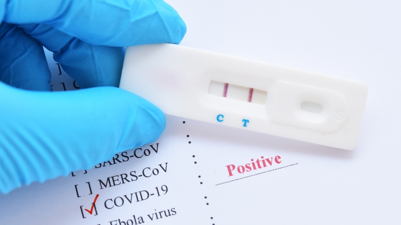 เช็กอาการติดโควิด-19 หนักแค่ไหนมีสิทธิเข้าโรงพยาบาล