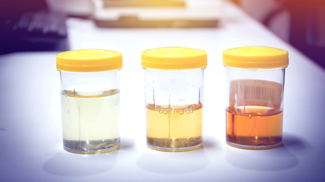 ชันสูตรปริมาณปัสสาวะในร่างกาย หาความจริงจากหลักนิติวิทยาศาสตร์ได้อย่างไร