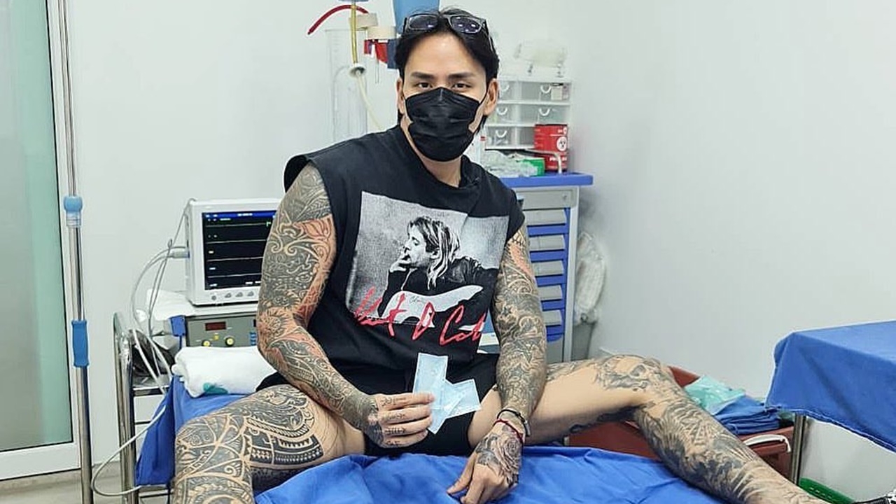 แทค ภรัณยู ฝังมุก 3 เม็ด คนแห่ขอดูรีวิวหลังทำ