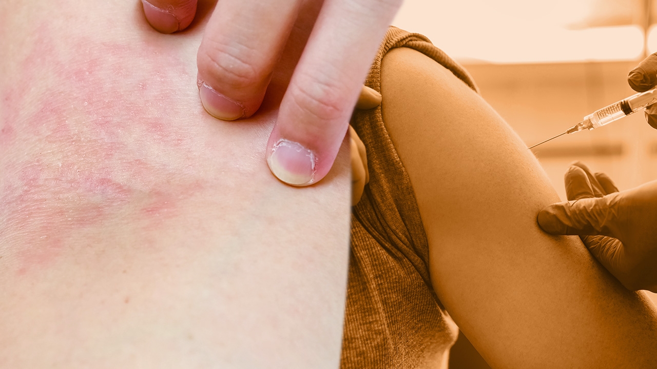 เช็กอาการแพ้วัคซีนไข้หวัดใหญ่ แบบไหนต้องระวังเป็นพิเศษ 