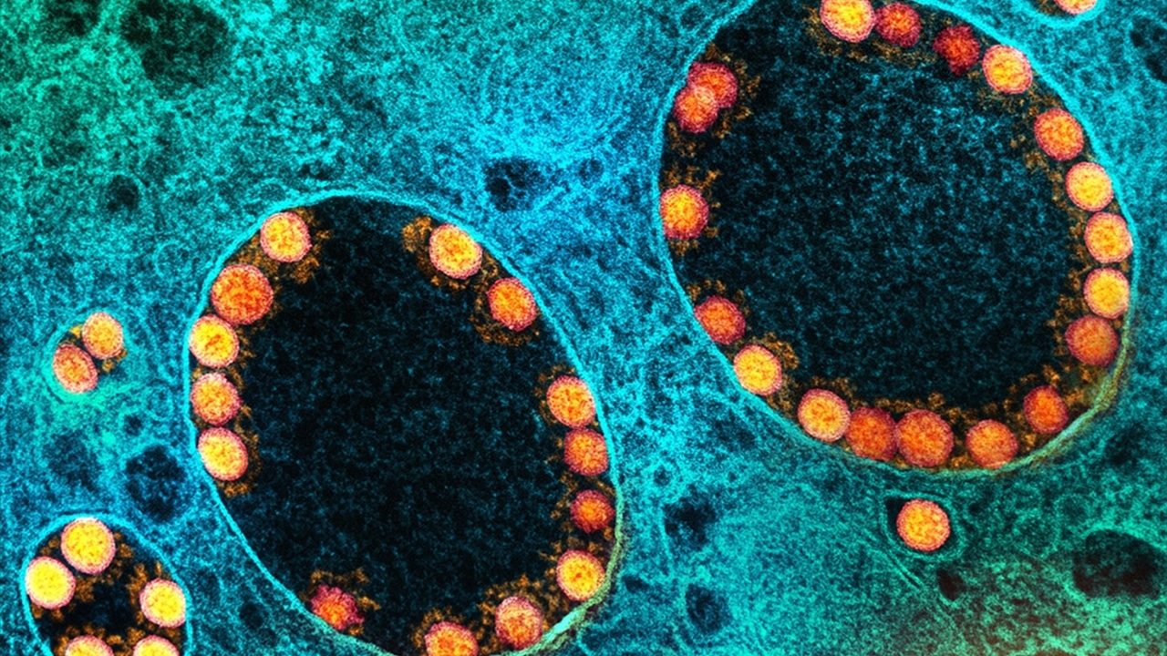 สิงคโปร์ผวา พบคนติดโอมิครอน BA.4 และ BA.5 ในประเทศครั้งแรก