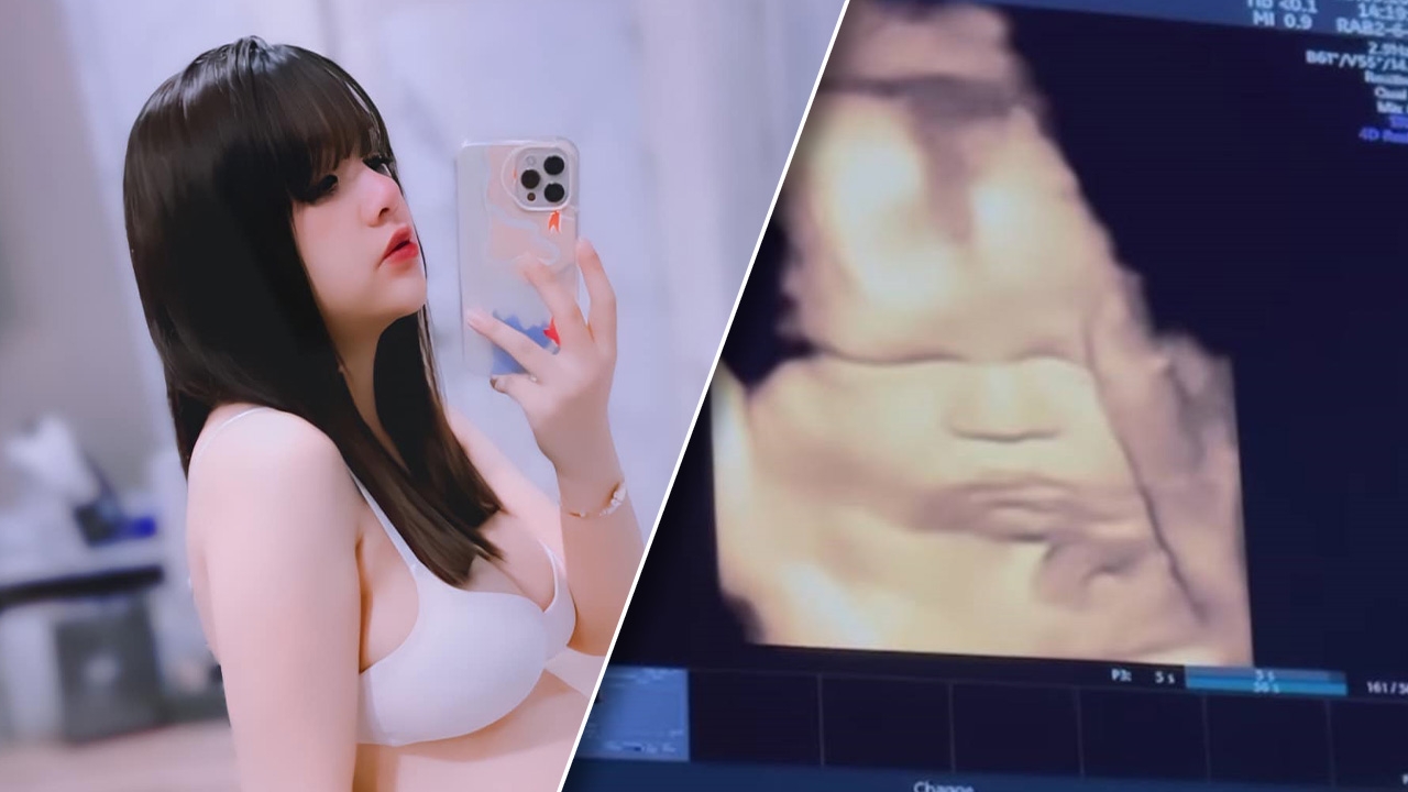 เจนนี่ ได้หมดถ้าสดชื่น เผยภาพอัลตราซาวนด์ น้องยูจิน ก่อนคลอด