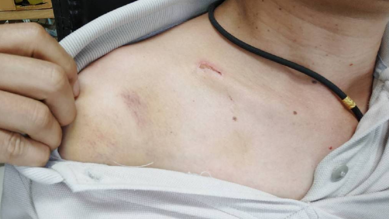 กลุ่มร่างทรงกร่าง จัดงานในวัดเสียงดัง ชาวบ้านไปเตือน กลับโดนเก้าอี้ฟาด