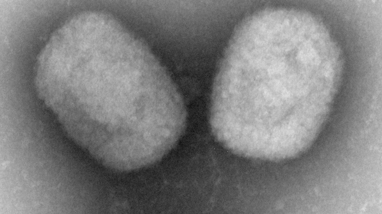 ยุโรปป่วยฝีดาษลิงแล้ว 100 ราย แต่ผู้เชี่ยวชาญเชื่อระบาดไม่นาน