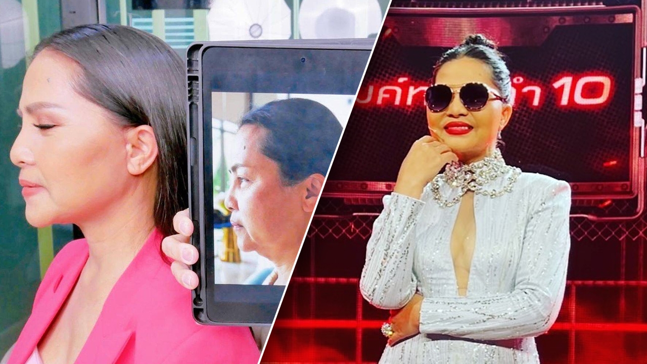 สุนารี เผยภาพหลังศัลยกรรม 1 เดือน แต่งานนี้ไม่ได้โฟกัสแค่หน้า