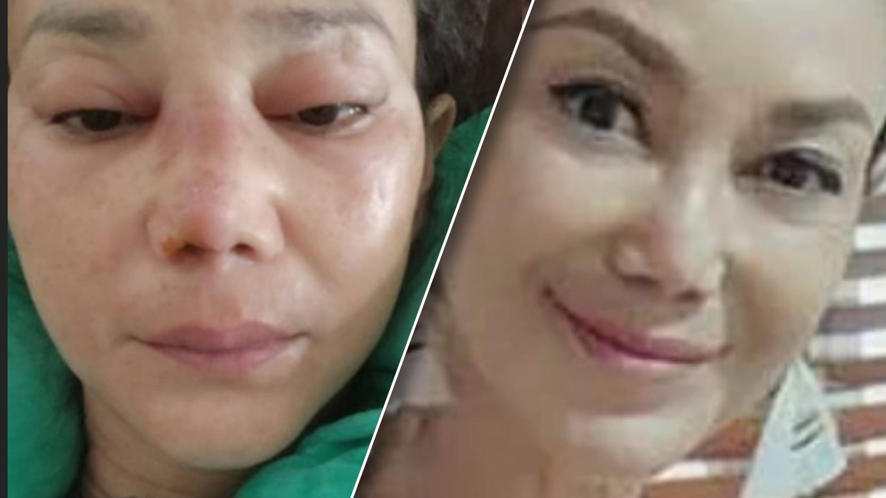 เอ๋ อัจฉรา ป่วยหลายโรครุมเร้า ช็อก หัวใจ-ไตวายเฉียบพลัน แต่รอดตาย