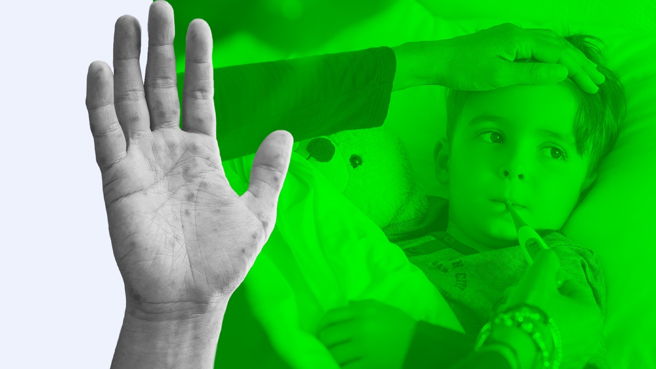 พ่อแม่ปวดใจ 5 โรคระบาดยอดฮิตในเด็ก ทำป่วยต้องแอดมิตบ่อย แนะวิธีป้องกัน