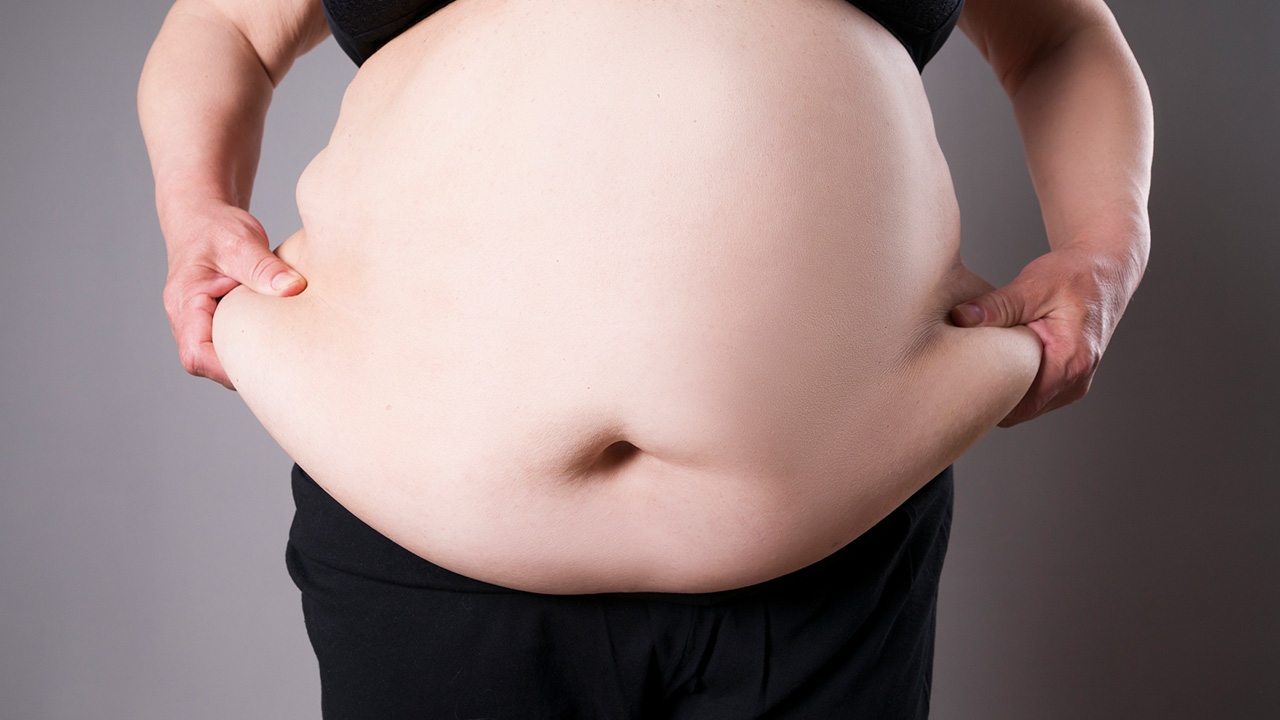 หมอเผย "คนอ้วน" ป่วยโควิด-19 เสี่ยงเกิดอาการรุนแรงเท่ากับผู้สูงอายุ