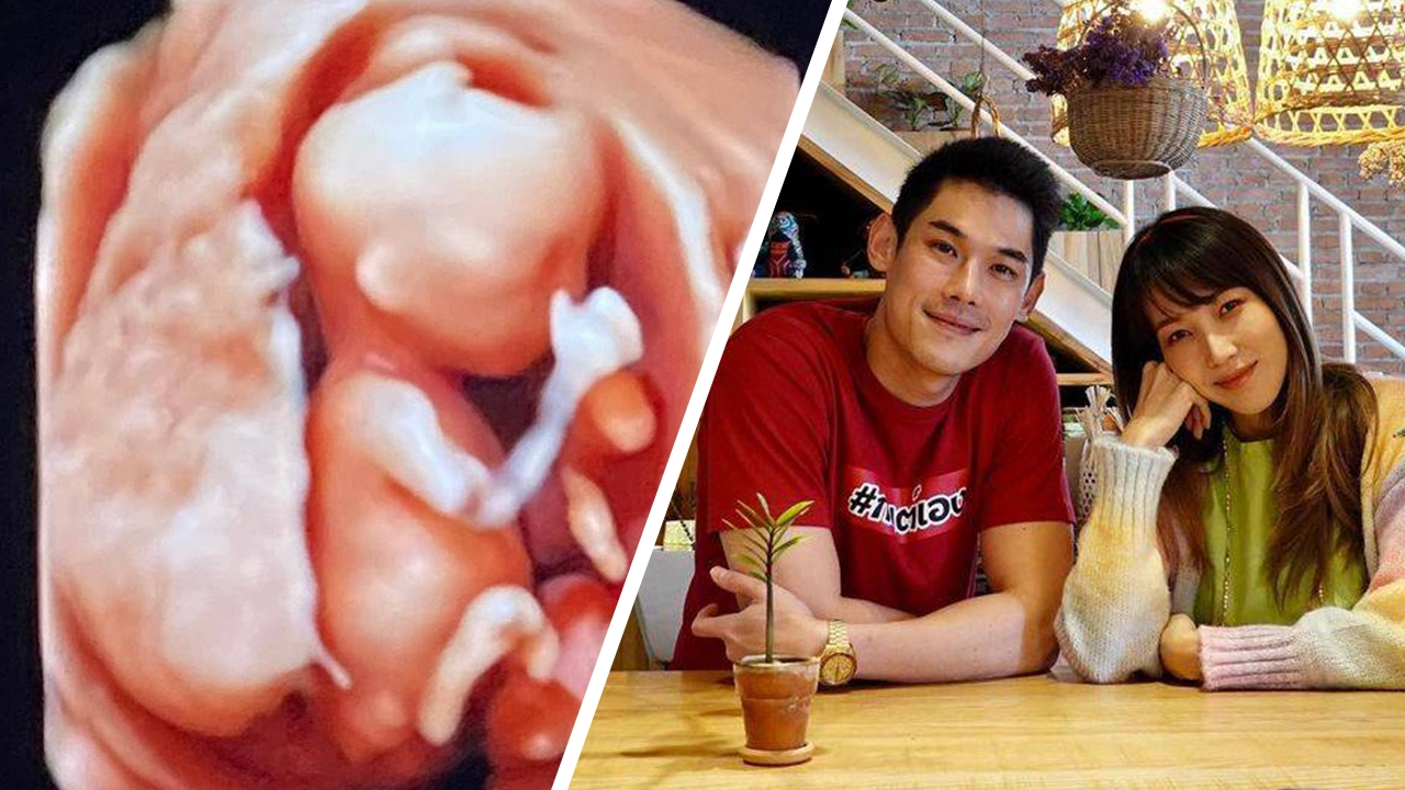 กันต์-พลอย เฉลยเพศลูกคนแรก หลังปิดเป็นความลับมานาน 2 เดือน