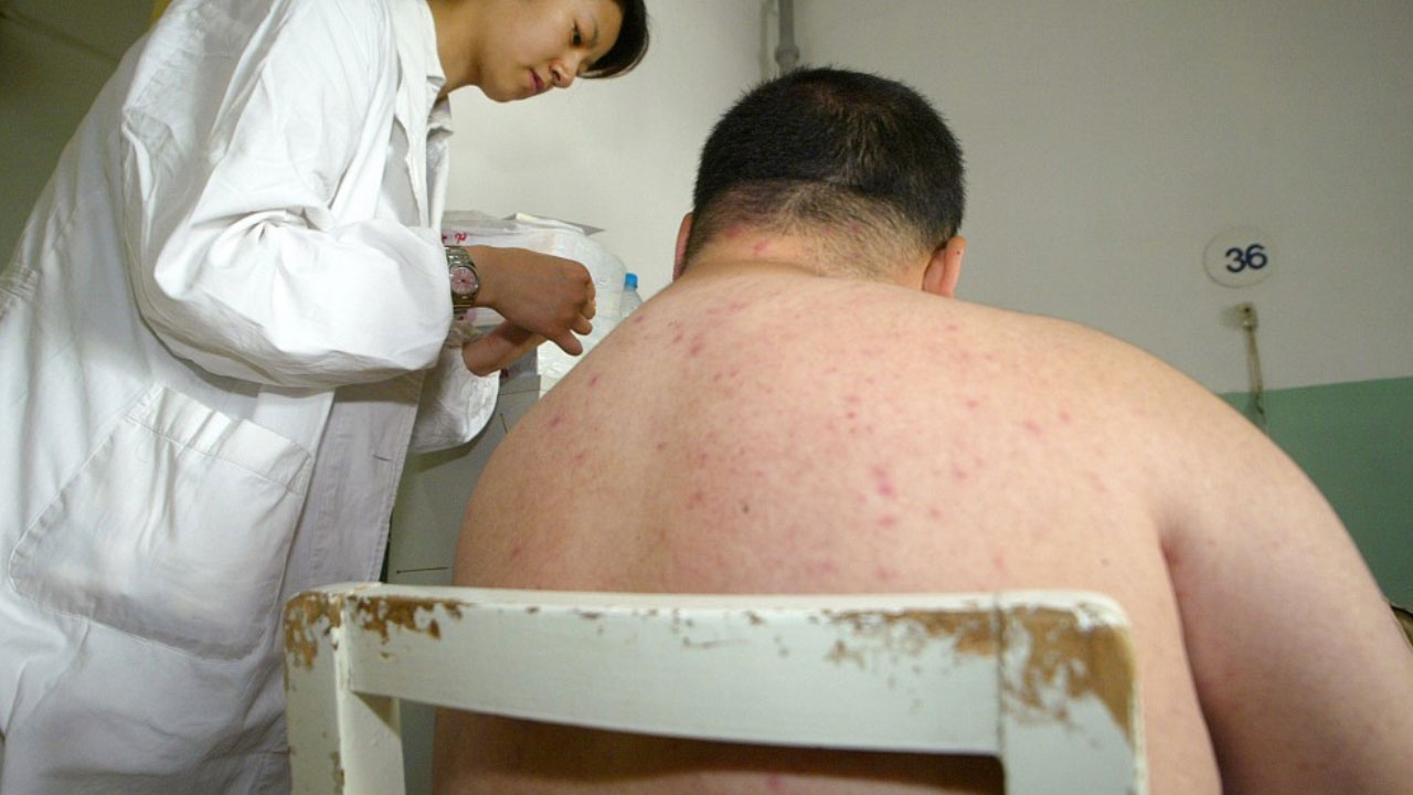 อึ้ง ผลวิจัยชี้ ผู้ใหญ่จีนเกินครึ่งน้ำหนักเกิน 16% เป็นโรคอ้วน