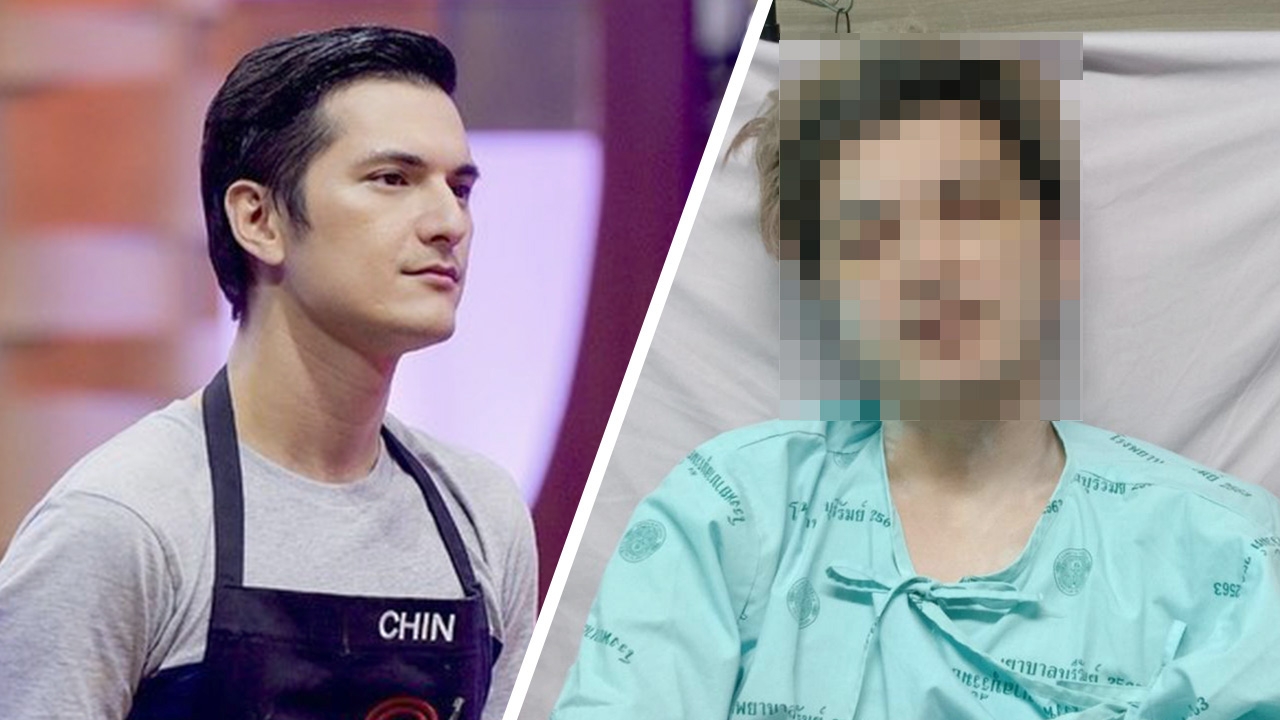 ชิน อัปเดตอาการน้องแบงค์ ถามคนรุมกระทืบจิตใจทำด้วยอะไร 