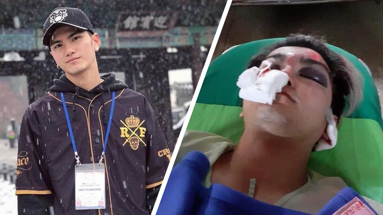 หล่อเกินหน้า วัยรุ่นเซราะกราว รุมกระทืบนายแบบหนุ่ม ยับคาร้านอาหาร 