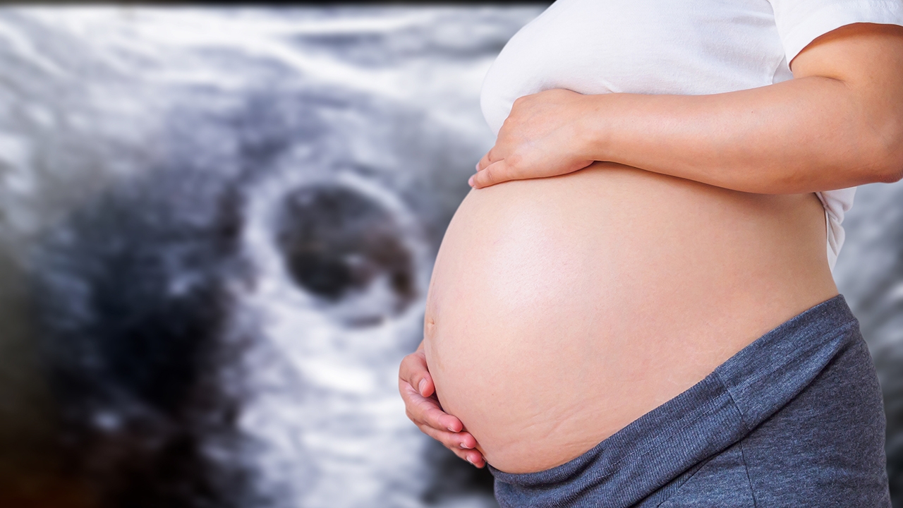 คลอดกฎหมายทำแท้งเสรี ยุติท้องไม่พร้อมปลอดภัย