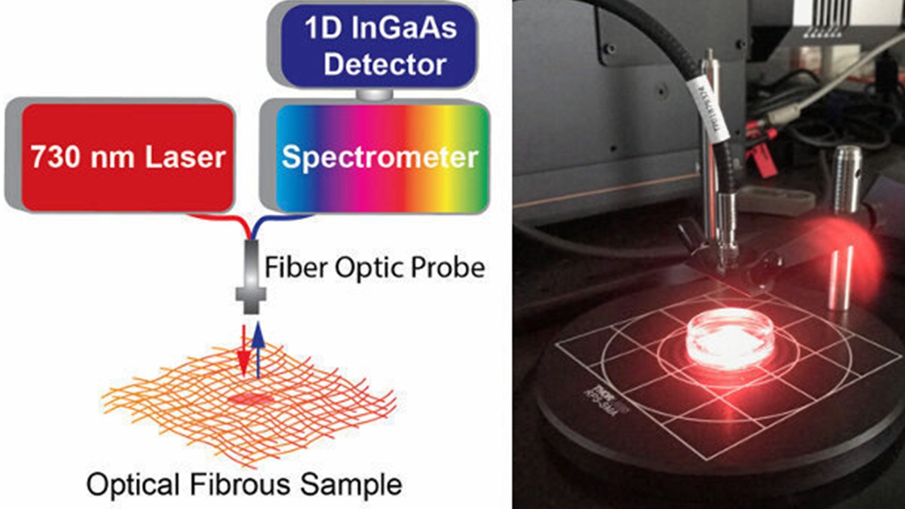 นักวิจัยสร้างผ้าพันแผลอัจฉริยะเพื่อวินิจฉัยการติดเชื้อในแผล