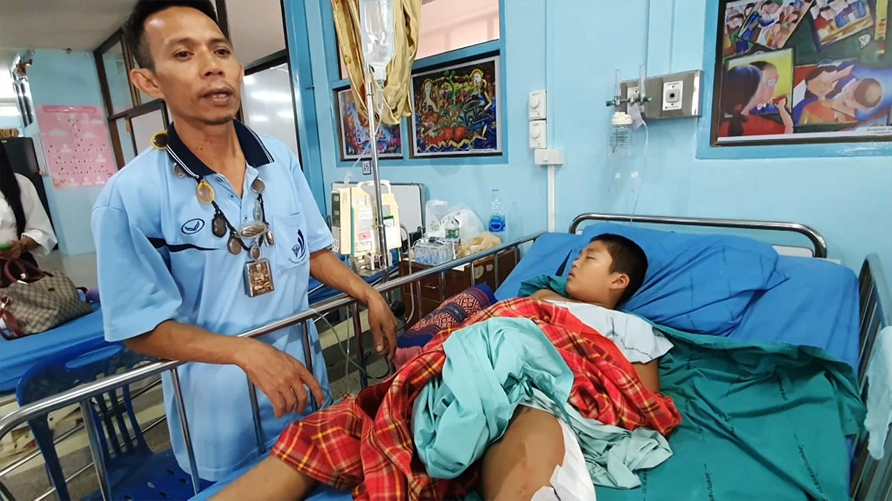 พ่อสุดทนลูก ป.4 ถูกเพื่อนรุมทำขาหัก 2 ท่อน แต่ครูปกปิดความจริง