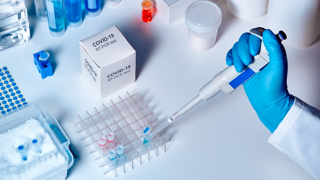 หมอแล็บ ย้ำตรวจหาโควิด ต้องใช้วิธี "RT-PCR" บางรายตาย เพราะ rapid test