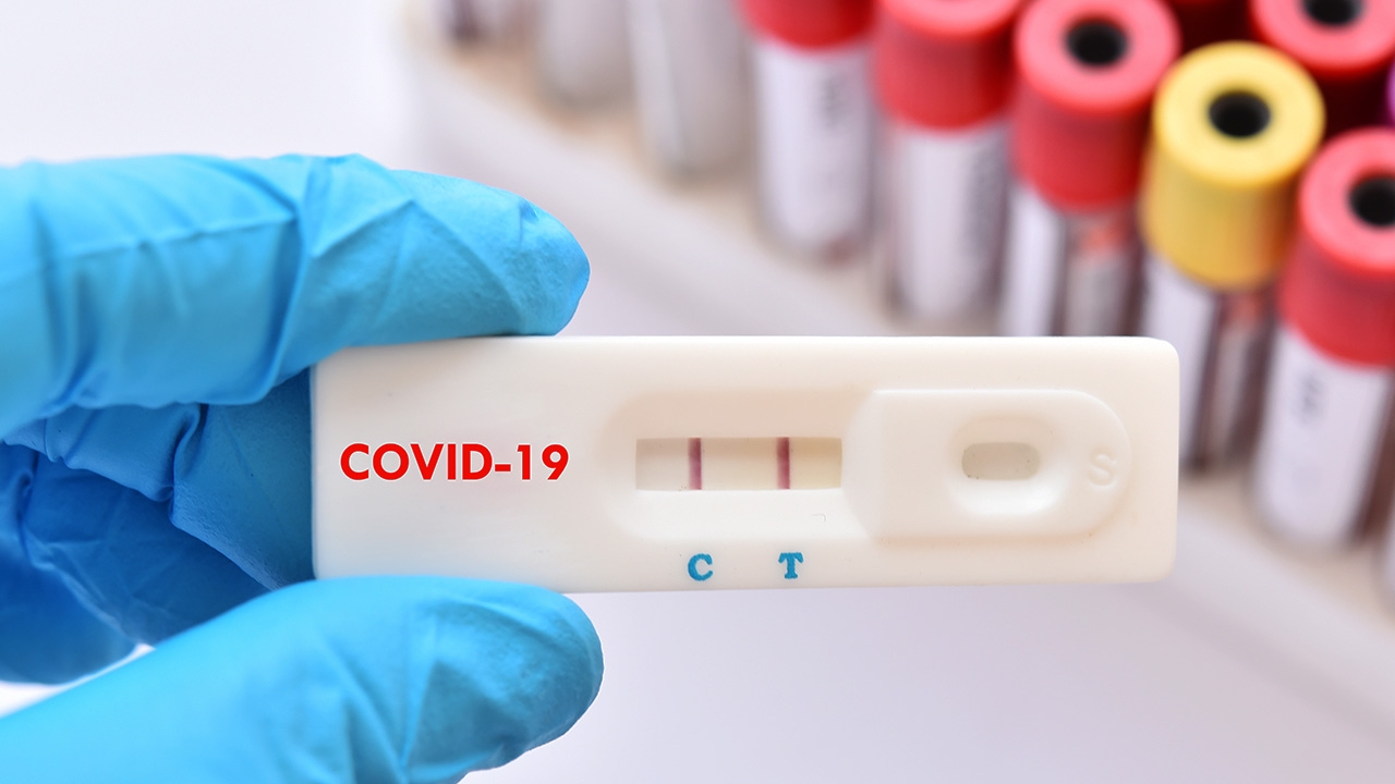 ดีเดย์ 3 ส.ค. สั่ง 8 ล้าน มี 3 แสน Antigen Test Kit แจกประชาชน