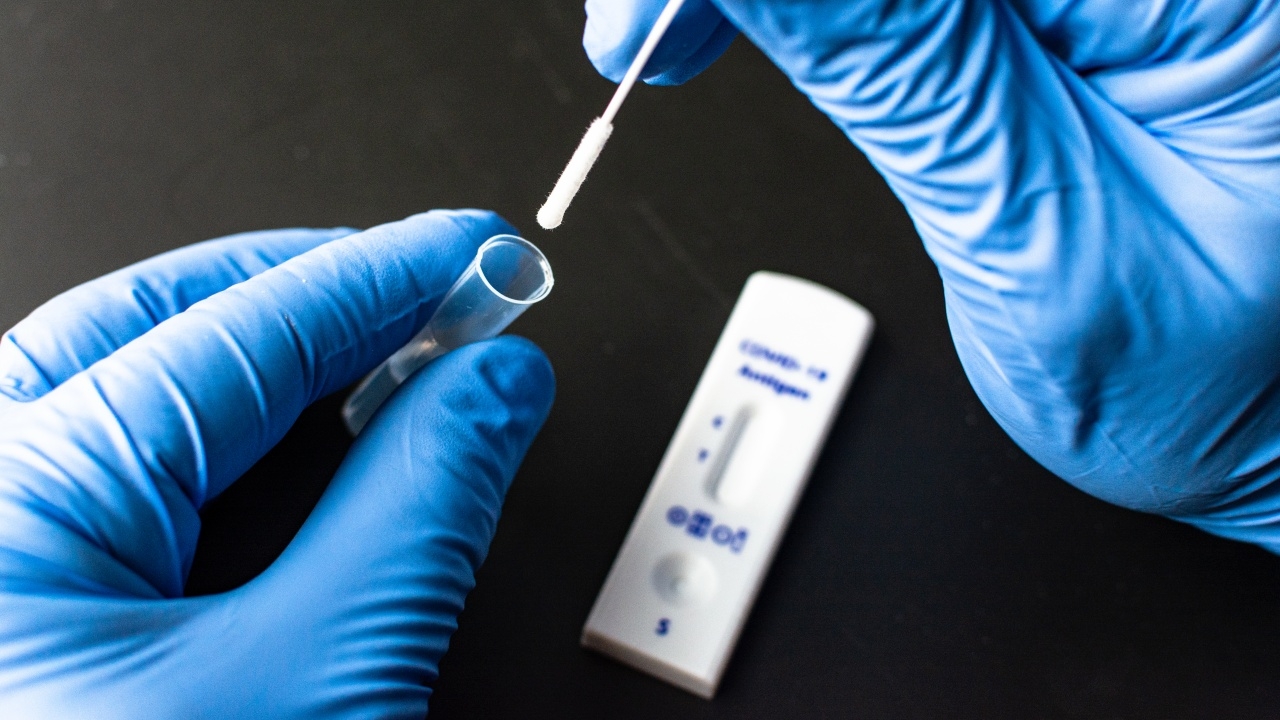 องค์การเภสัชกรรม ยันซื้อชุดตรวจโควิด ATK 8.5 ล้านชุด ตามเงื่อนไข สปสช.