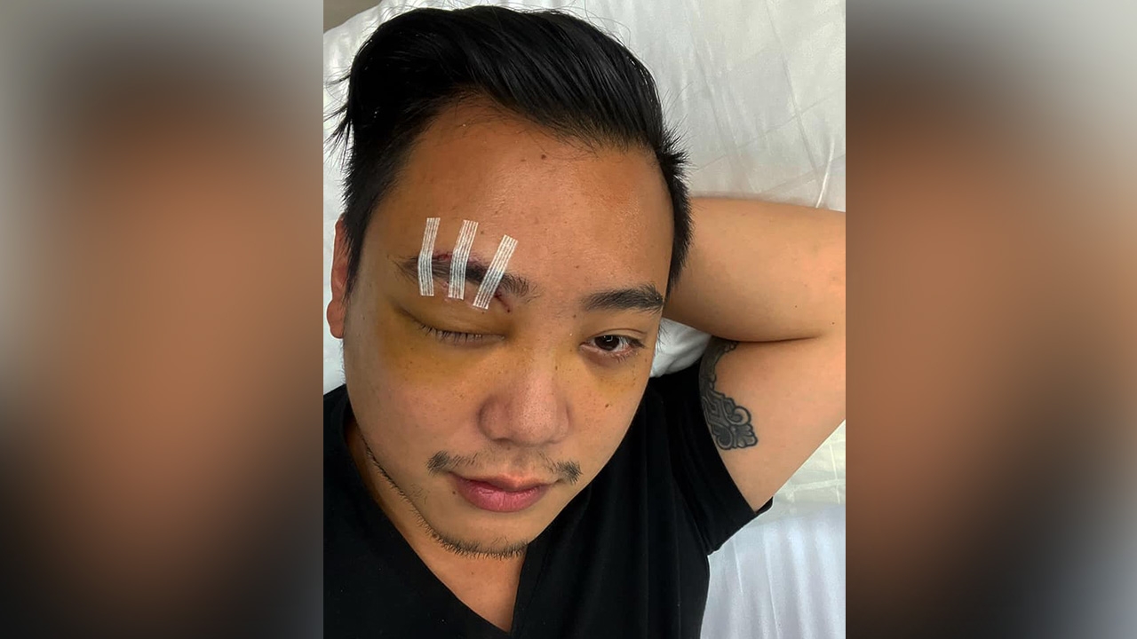 "ไฮโซลูกนัท" เผยภาพล่าสุด ได้กลับบ้านแล้ว หลังเข้ารักษาดวงตา