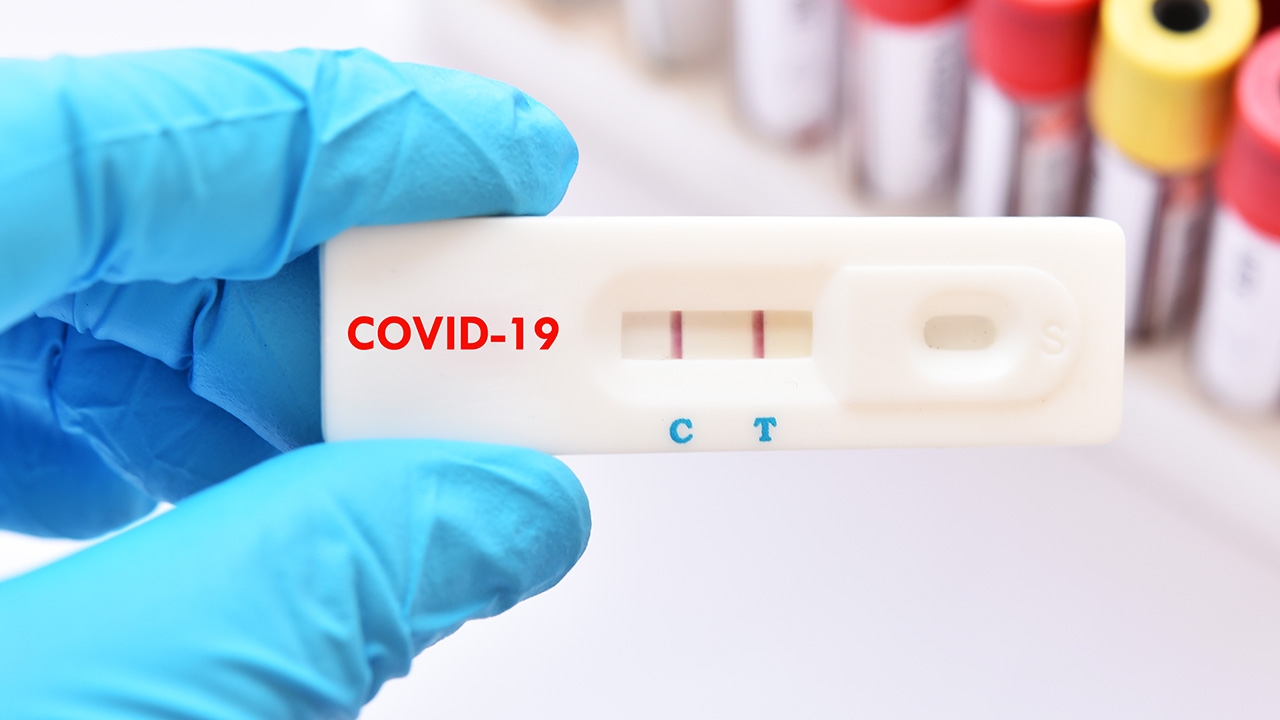 ชุดตรวจโควิด ATK  แยกด่วนรักษาเร็ว