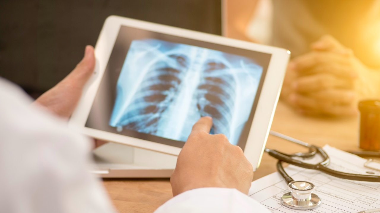 ไขคำตอบ โควิดลงปอดอาการเป็นอย่างไร แนะผู้ป่วยหมั่นสังเกตตนเอง