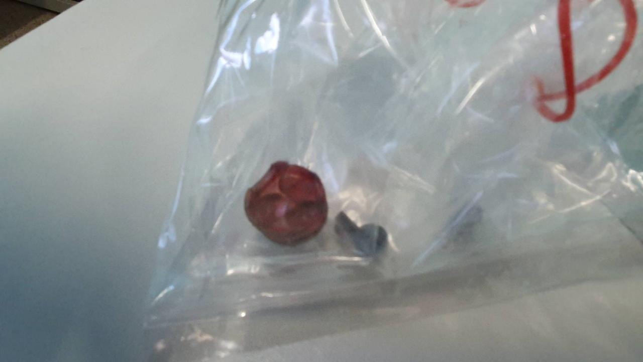 ตร.น่านตามจับคนร้ายแก๊งยายิงเพื่อนบ้านตาย 1 สาหัส 1 คาดแค้นรู้เรื่องค้ายา