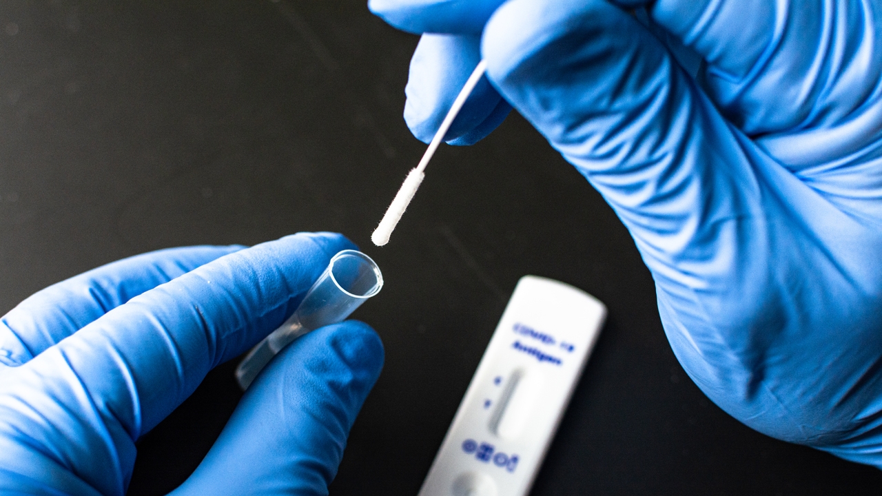 ได้รับ ATK แล้ว วอนรีบตรวจ-แจ้งผล บริษัทประกันโละพนักงาน เอามาจ่ายสินไหม