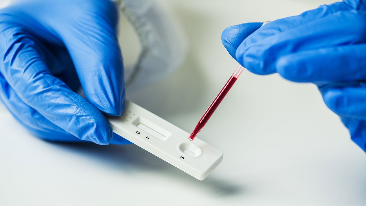 ย้ำชุด Antigen Test Kit ต้องศึกษา ตรวจรอบคอบสกัดผลลวง