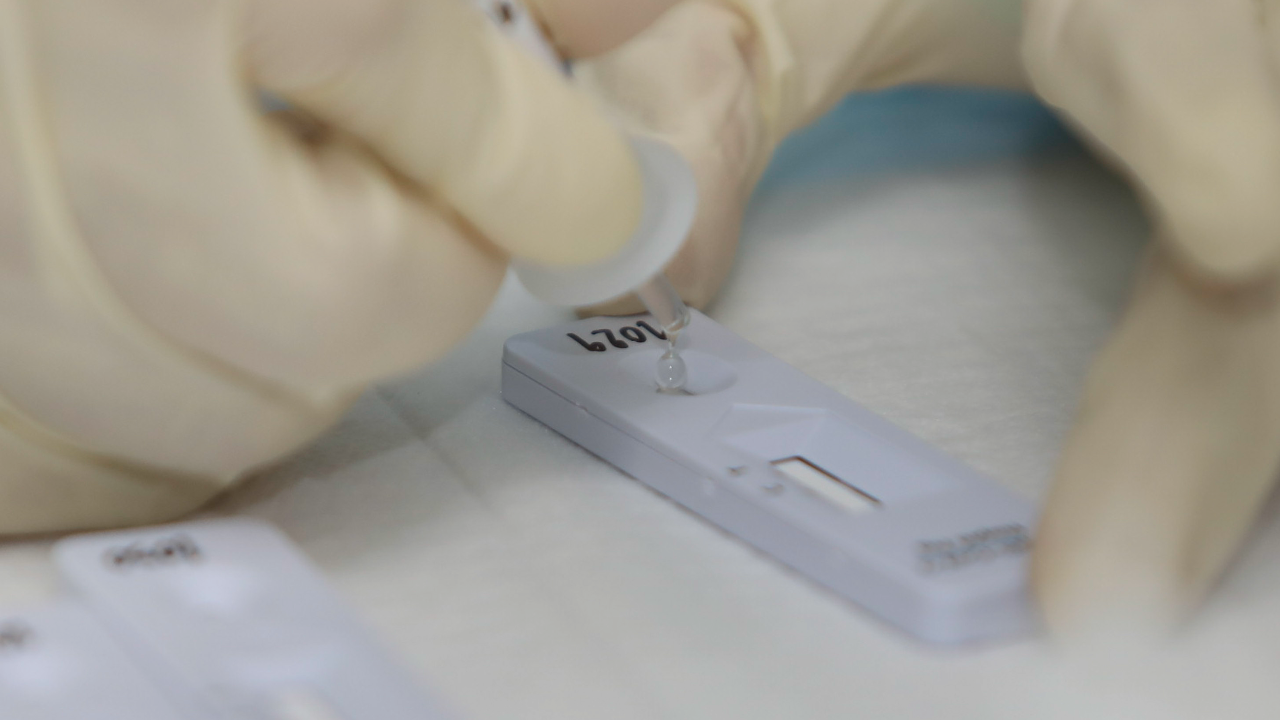 เผยผลตรวจโควิดด้วย Antigen Test Kit 50,000 กว่าราย พบติดเชื้อราว 10%