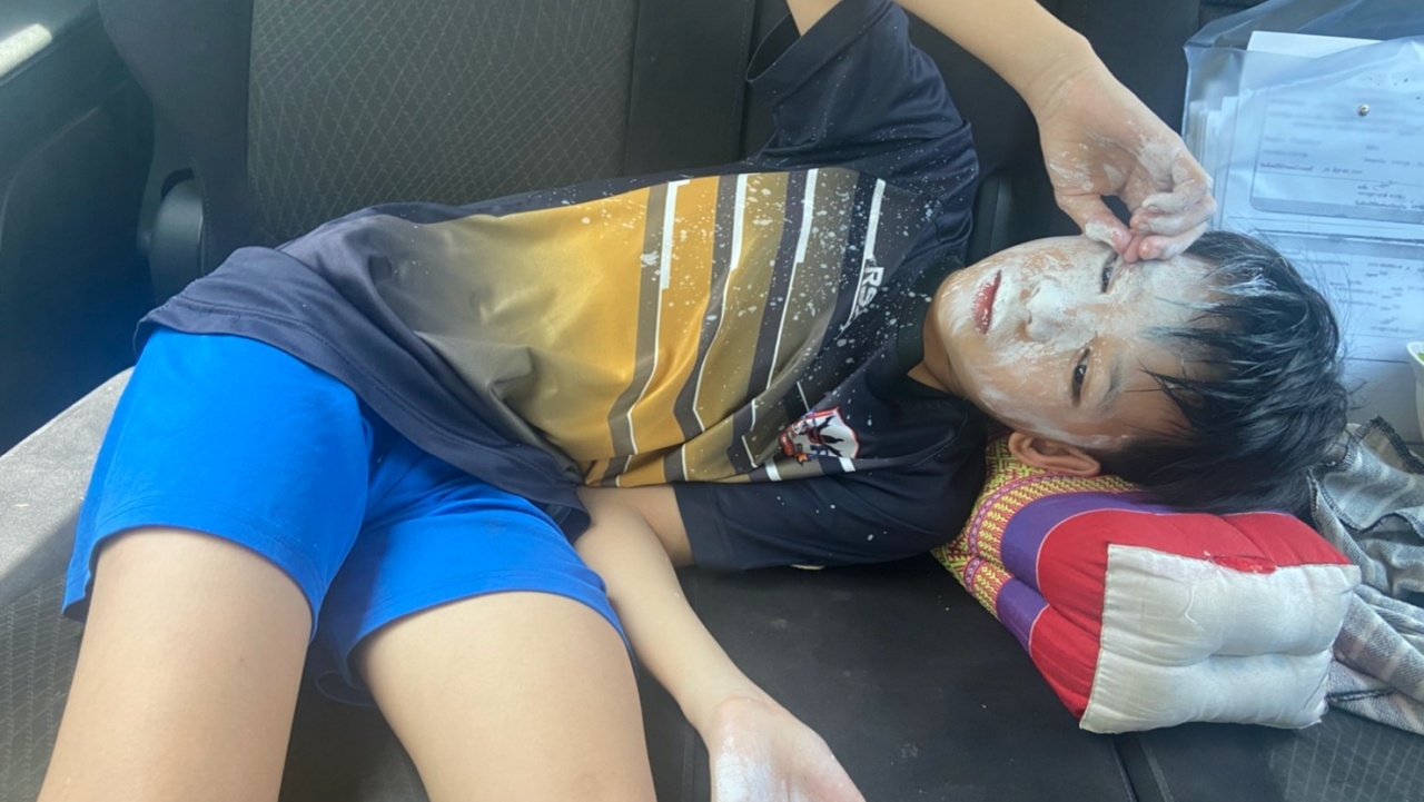 น้ำยาลบคำผิดระเบิดใส่หน้า ด.ช.10 ขวบ ยังดีบาดเจ็บเล็กน้อย แต่ล้างไม่ออก