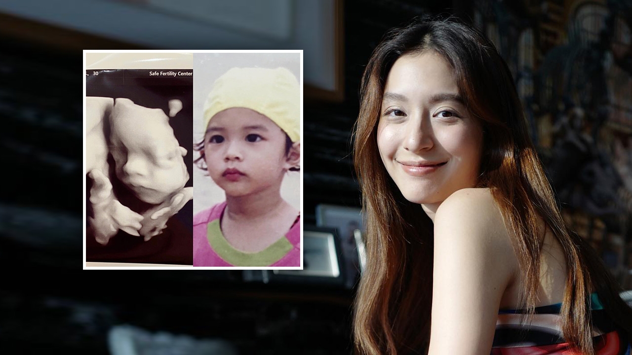 มิว นิษฐา โพสต์ภาพอัลตราซาวนด์ลูกสาว เทียบรูปแม่ตอนเด็ก เหมือนเป๊ะมาก