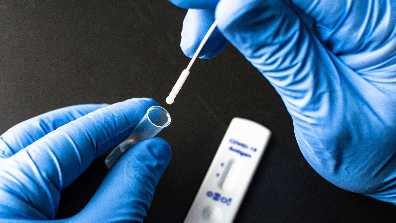 เสริมการตรวจโควิด ด้วยชุดตรวจ Antigen test kit ลดความแออัด รอคิวข้ามวัน