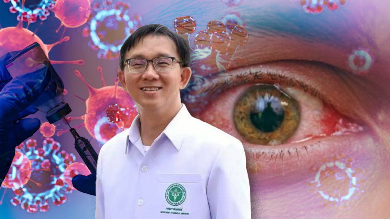 "เยื่อบุตาอักเสบ-ตาแดง" อาการนําโควิดสายพันธุ์ XBB.1.16