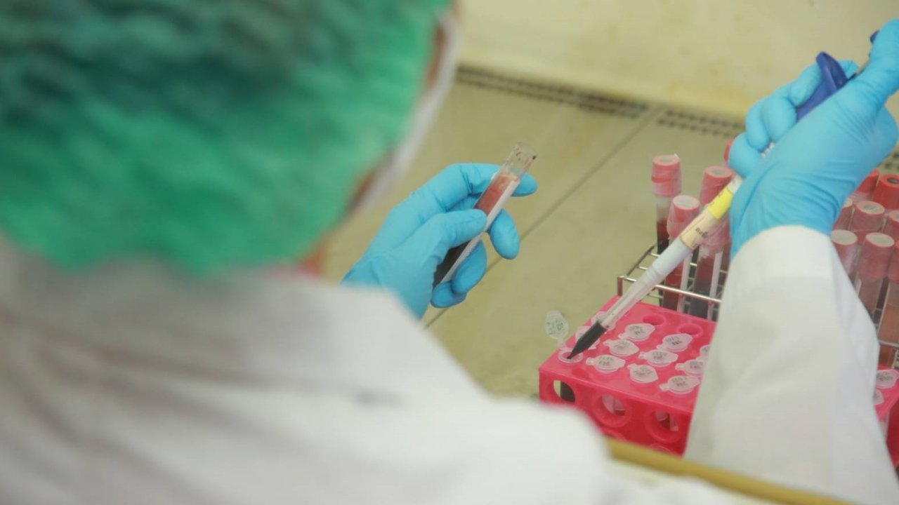 นิติวิทยาศาสตร์ แจงแนวทางขอผ่าชันสูตรศพที่ตายผิดธรรมชาติ หลังมีคดีไซยาไนด์