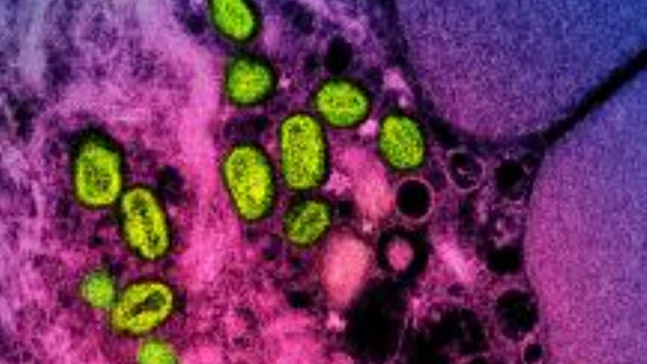 สหรัฐฯ เตือนโรค ‘เอ็มพอกซ์’ (ฝีดาษลิง) เสี่ยงระบาดรอบใหม่