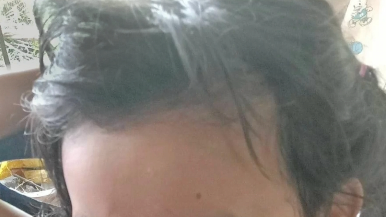 โรงเรียนขอโทษแล้ว สั่งย้ายครูโยนหนังสือใส่เด็ก ป.2 หัวแตกไปฝ่ายอื่น