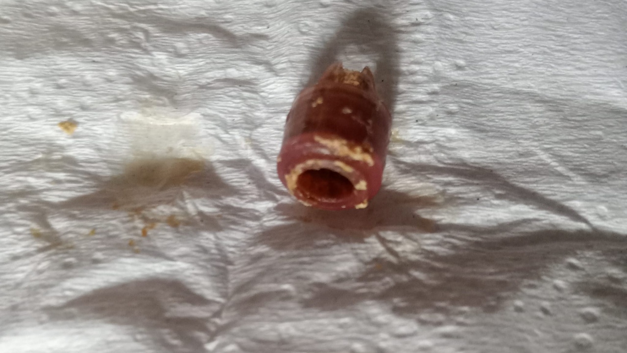 คุณแม่ช็อก เจอ "จุกดินสอเปลี่ยนไส้" ติดอยู่ในจมูกลูก หลังได้กลิ่นเหม็น