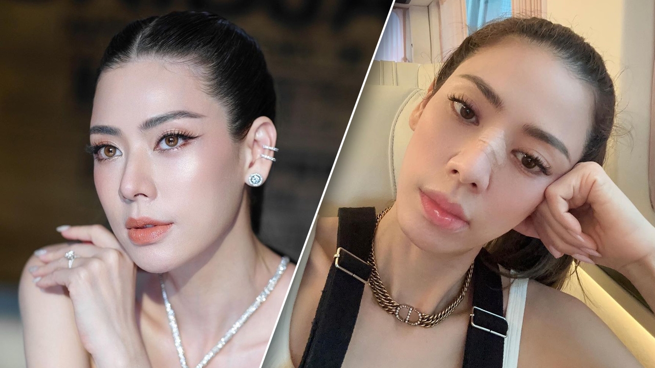 เอ๋ พรทิพย์ เซ็งซวยซ้ำซ้อน เพิ่งหายโควิด ล่าสุดโดนนกกัดจมูกเลือดสาด