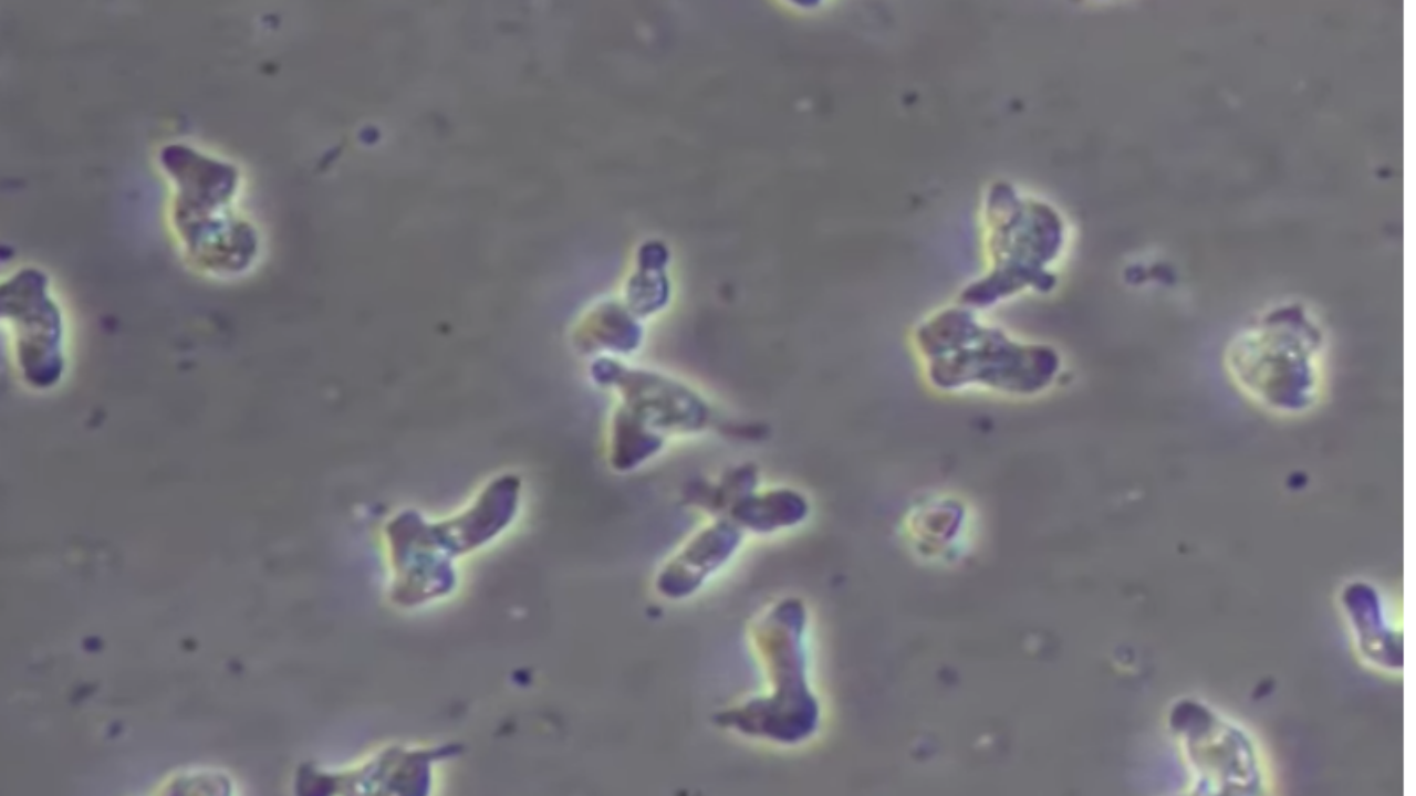 ช็อก ชายฟลอริดาติดเชื้ออะมีบากินสมอง เสียชีวิต คาดใช้น้ำประปาล้างจมูก