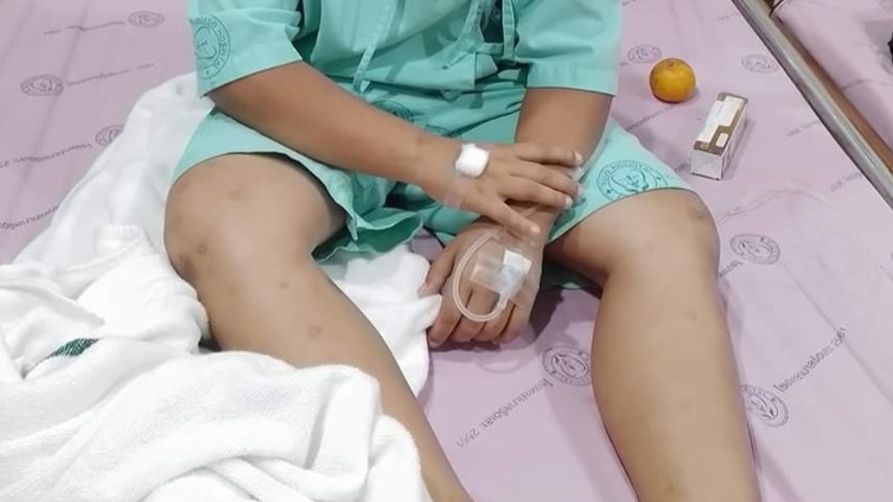 เกินไปไหม สั่งลงโทษเด็ก ป.3 ลุกนั่ง 300 ที จนเดินไม่ได้ ปัสสาวะไม่ออก