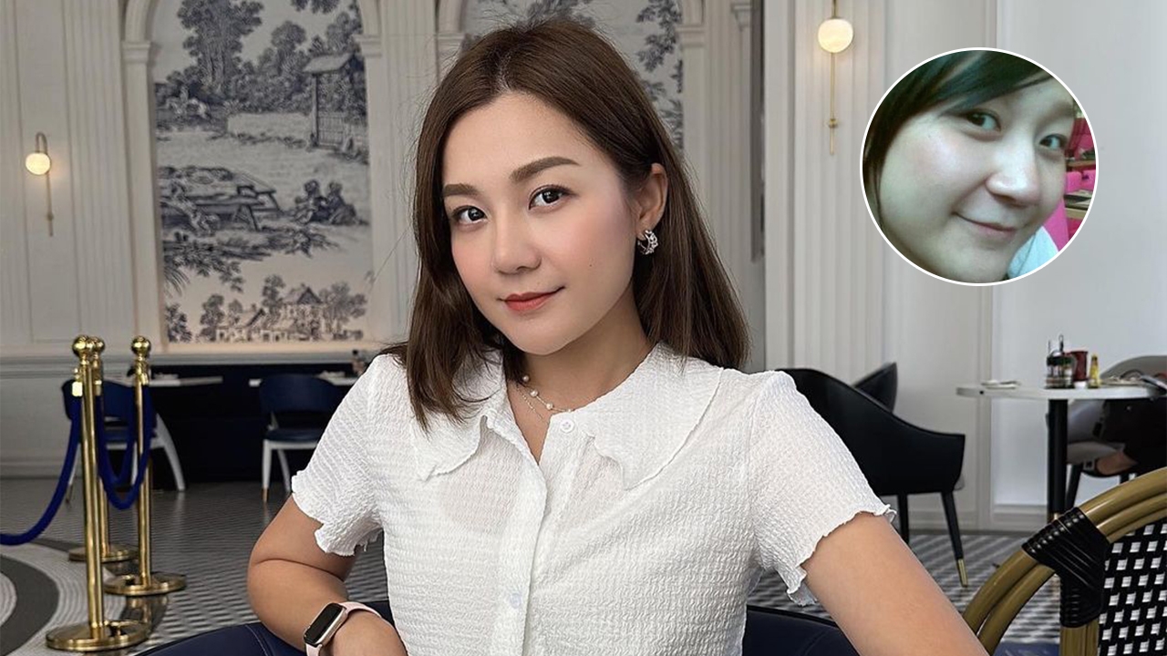 ใครว่าแหมบ เอ็ม ลูกหม่ำ โพสต์รูปวันวานโชว์จมูกแท้ เตรียมรอดูเวอร์ชันใหม่