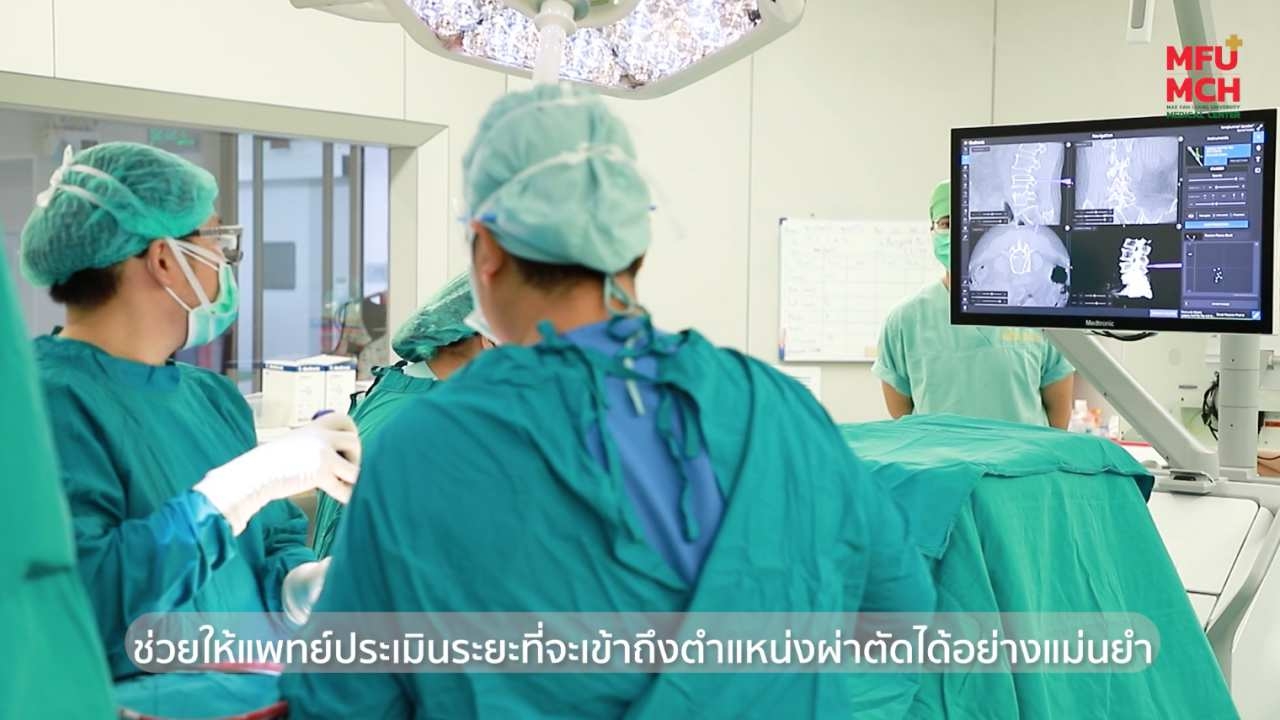 รพ.ศูนย์การแพทย์ ม.แม่ฟ้าหลวงนำเทคโนโลยีช่วย ผ่าตัดกระดูกสันหลังแบบแม่นยำ