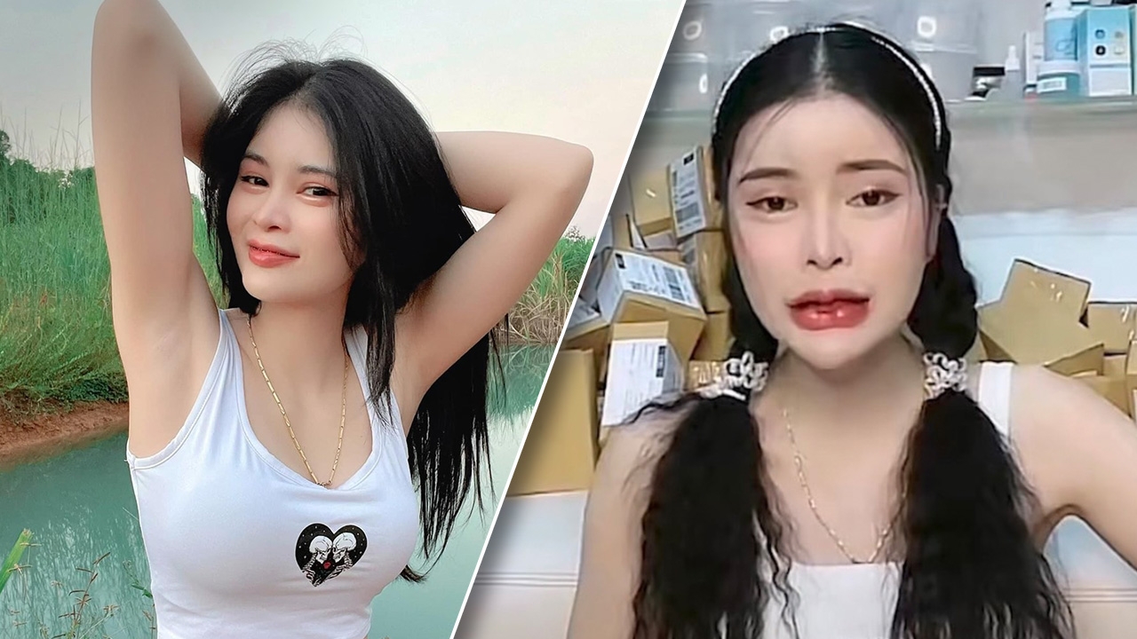 เอ๋ มิรา โมโหโดนคนทักหลังฉีดปาก แจงหน้าเปลี่ยนทุก 6 เดือนเพราะกลัวคนเบื่อ