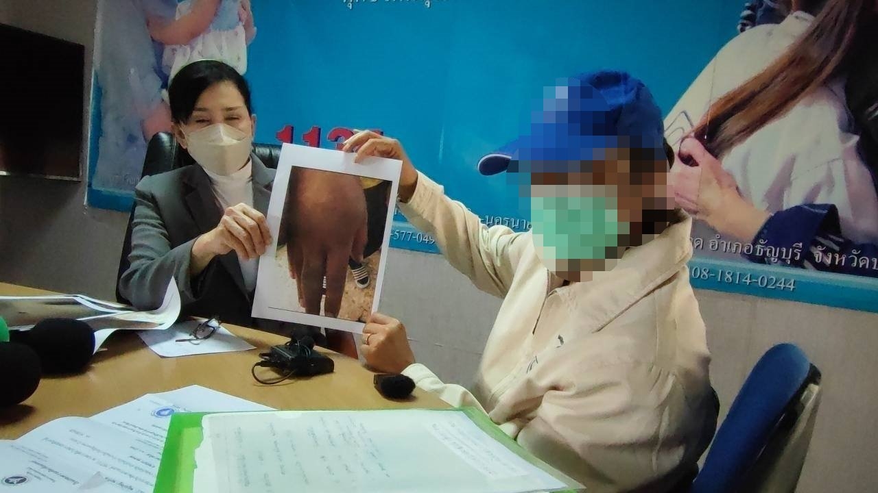 แม่พาลูกชายออทิสติกร้องปวีณา ช่วยตามคดีถูกทารุณกรรมในสถานรับเลี้ยง เกรงคดีไม่คืบ