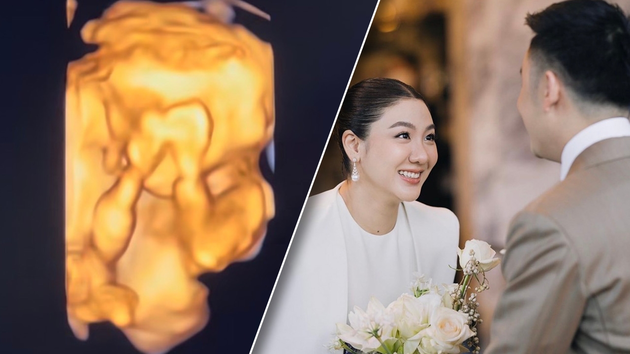 ใบเตย พรพจี ประกาศข่าวดี ตั้งท้องแล้ว โพสต์คลิปอัลตราซาวนด์ของลูกน้อย