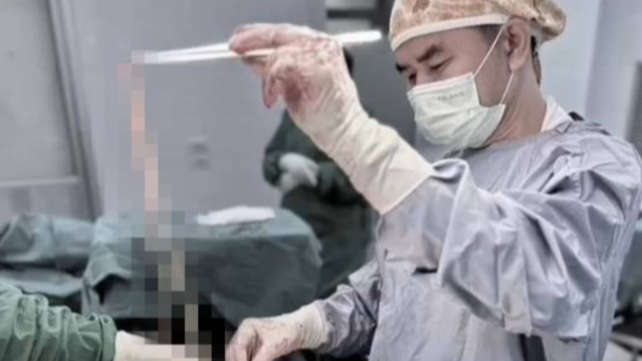 อวสานสายกินดิบ คนไข้ปวดท้องรุนแรง พบพยาธิตืดวัวอุดตันลำไส้จนเน่า