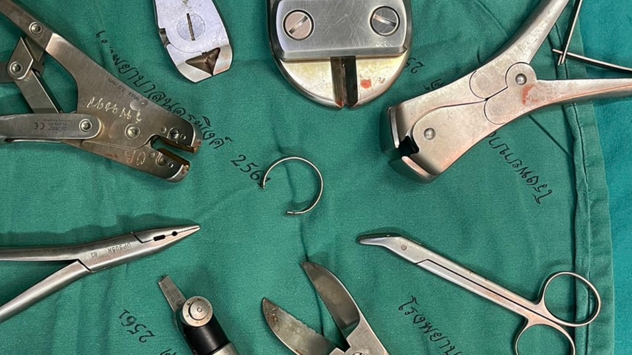 อย่าหาทำ หนุ่มพม่าใส่ห่วงรัดอวัยะเพศ หวังเพิ่มขนาด สุดท้ายเลือดคั่งหวิดเน่า